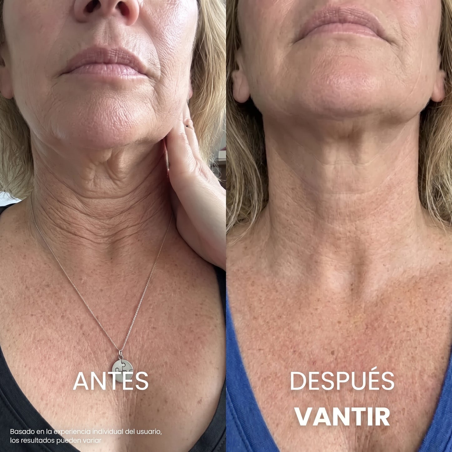 Crema Anti-Flacidez + Péptidos y Ácido Hialurónico