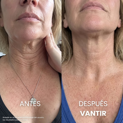Crema Anti-Flacidez + Péptidos y Ácido Hialurónico